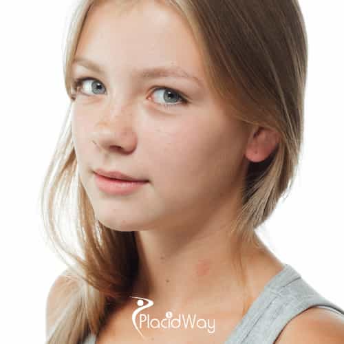 7 Things Young Adults in the US Should Ask Before Getting a Rhinoplasty in Tijuana